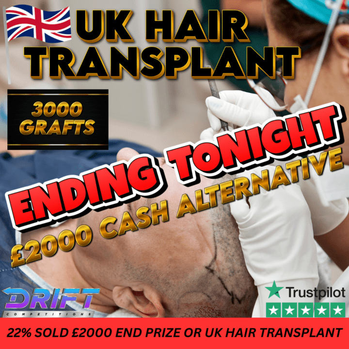 UK HAIR TRANSPLANT 3000 GRAFTS OR £2000 CASH ALTERNATIVE